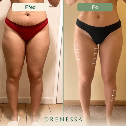 Drenessa – český obrázek produktu 10