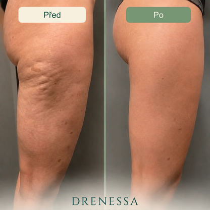 Drenessa – český obrázek produktu 11