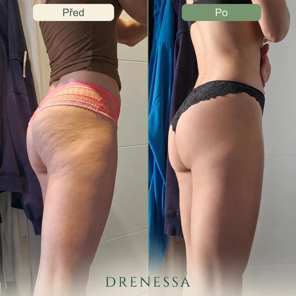 Drenessa – český obrázek produktu 12